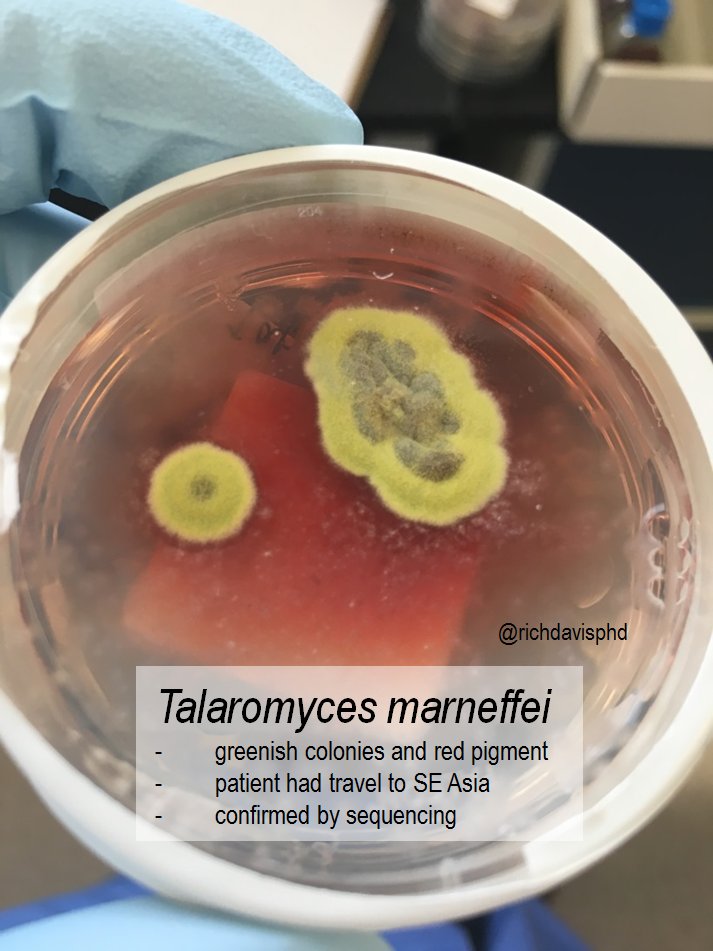 richdavisphd's tweet photo. Infectious disease doc &amp; medical micro fellow @Ahmed_HBabiker helped start and runs the amazing @Emory_MedMicro with @colleenkraftmd for clinical/lab education on infectious organisms.

Here's a rare but amazing fungi: Talaromyces marneffei  #LabWeek2020 #VirtualLabWeek #MLPW2020 https://t.co/mkiXaYLZ61