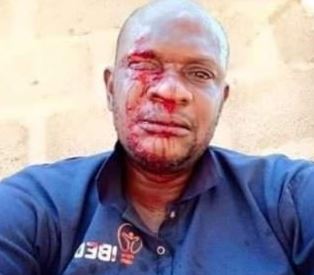 SO SAD! PHCN STAFF ATTACKED WHILE DISTRIBUTING BILLS IN OGUN STATE oravoices.com/2020/04/so-sad…