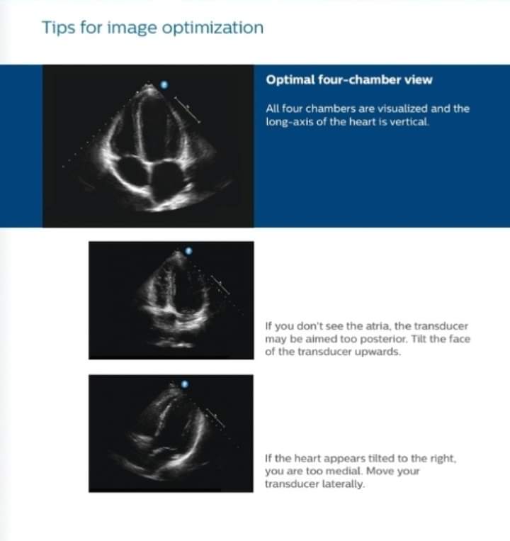 fazalabul's tweet photo. Easy tips for image optimization
https://t.co/fV4PemW3pP https://t.co/XW4h3Iq7E6