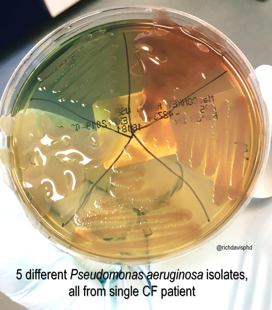 richdavisphd's tweet photo. For two other lab professionals at Colorado Children's, @darcyavelasquez and @CTMylius (along w/ @andreaprinzi &amp; @SJLovesMicro) here's a horrible rainbow of different Pseudomonas aeruginosa isolates, all from the same CF patient. 

#LabWeek2020 #VirtualLabWeek #MLPW2020 https://t.co/Oi6H6tNWHg