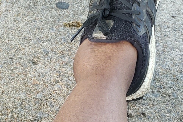 SlaughterMe1's tweet image. Please support my GoFundMe campaign: gofundme.com/f/xkvc8-broken… @gofundme