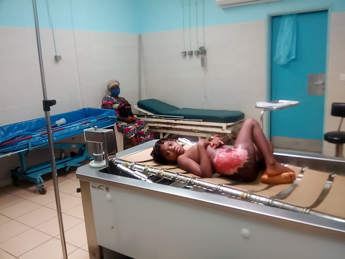 Jacques Marcel Itiga Itiga (@itigson) on Twitter photo Brûlée par le feu depuis 15 mois, la petite Anne (10 ans) a besoin de votre soutien pour rassembler les 3 047 000 Francs CFA nécessaires pour sa prise en charge #UrgenceCanal2International, <a href="/DrManaouda/">Dr MANAOUDA MALACHIE</a> <a href="/minasofficiel/">Ministère des Affaires Sociales #MINAS</a> <a href="/minproffcmr/">Minproff</a> @brendabiya Brûlée par le feu depuis 15 mois, la petite Anne (10 ans) a besoin de votre soutien pour rassembler les 3 047 000 Francs CFA nécessaires pour sa prise en charge #UrgenceCanal2International, <a href="/DrManaouda/">Dr MANAOUDA MALACHIE</a> <a href="/minasofficiel/">Ministère des Affaires Sociales #MINAS</a> <a href="/minproffcmr/">Minproff</a> @brendabiya