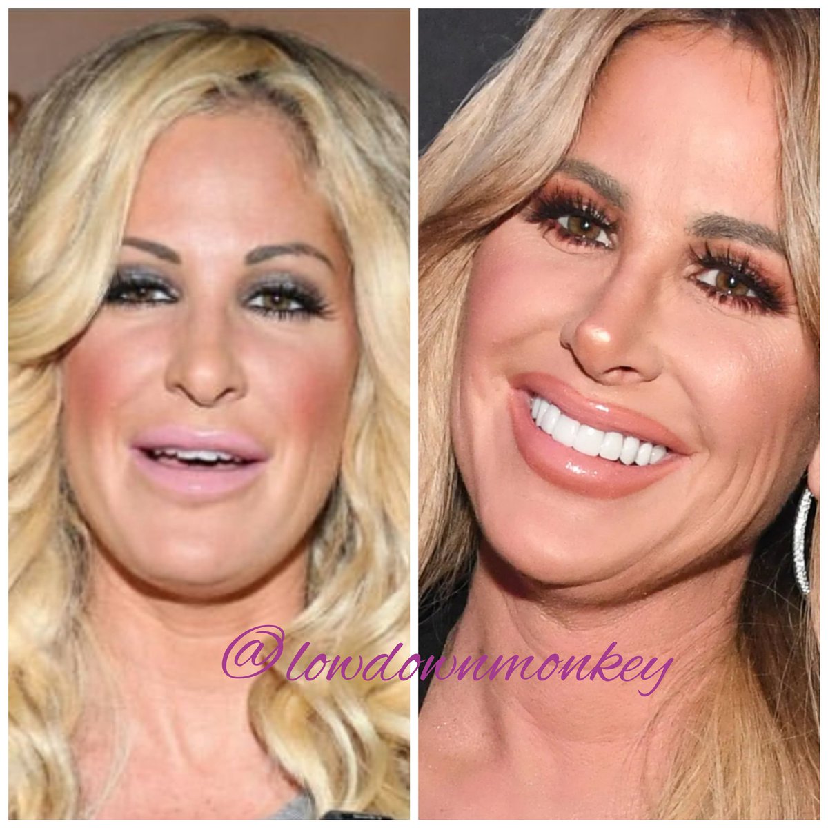 lowdownmonkey's tweet image. 😂😂 
Active on IG as well

@lowdownmonkey