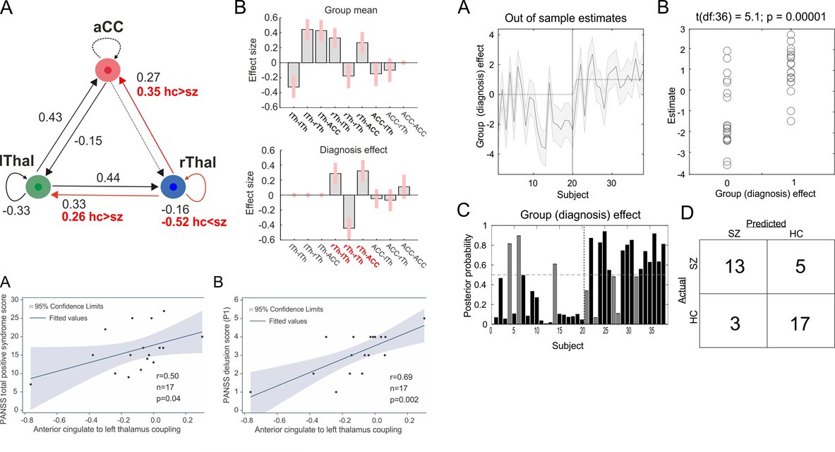 Gabor Stefanics (@gaborstefanics) on Twitter photo Fronto-thalamic structural and effective #connectivity and
#delusions in #schizophrenia: a combined #DTI/#DCM study
Check out our new paper on resting-state fronto-thalamic coupling and delusions @PsychMedJournal by <a href="/GCsukly/">Gábor Csukly</a> et al. bit.ly/3cLCUH5 Fronto-thalamic structural and effective #connectivity and
#delusions in #schizophrenia: a combined #DTI/#DCM study
Check out our new paper on resting-state fronto-thalamic coupling and delusions @PsychMedJournal by <a href="/GCsukly/">Gábor Csukly</a> et al. bit.ly/3cLCUH5