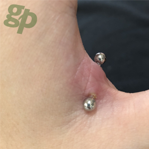 greenpiercing's tweet photo. https://t.co/uCIdtlaN3Q
【フォトGP No.04946】D=13さんの手のボディピアス

#グリーンピアッシング #フォトGP #ボディピアス #ボディーピアス #ボディピ #ピアス好きな人と繋がりたい #ピアス好きな人RT
#ハンドウェブ #親指と人差し指の間
#greenpiercing #HandwebPiercing https://t.co/fOBbOYmrXG