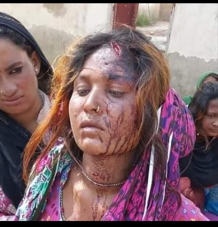 umarsherani9's tweet photo. Upsetting news coming where a #Hindu lady from #Sindh beaten by extremist goons just because she was fetching #water from a Soomra hand-pump. We strongly condemn such inhuman act.
#SaveHinduCommunity https://t.co/8oKZleTmqs