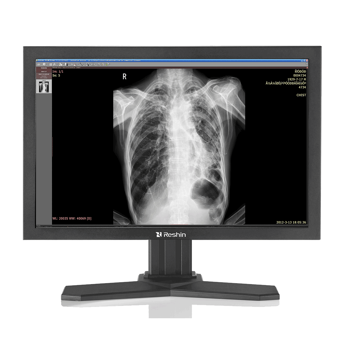 jlddisplay's tweet image. Why do Top-selling diagnostic radiology monitors witth stable brightness MD23C always attract you? See: medicalmonitor.net/top-selling-di… #surgicaldisplays #monitormedicalsupplies #cheaplcdmonitor