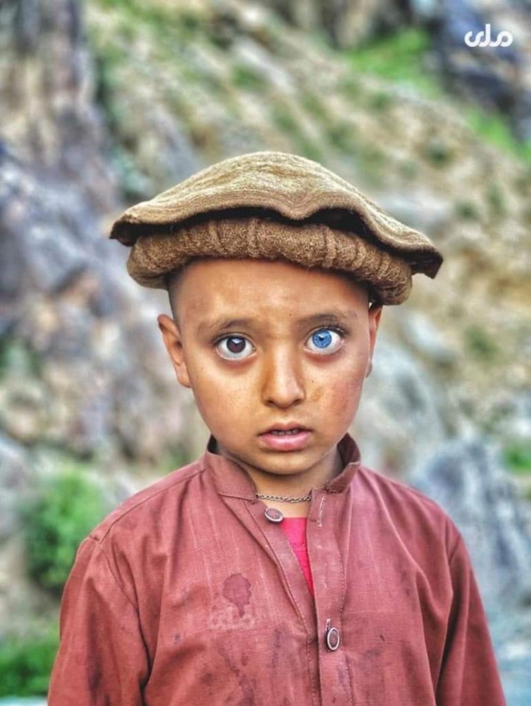 A 5-year-old boy from Surkhrod district of Nangarhar has such unique eyes, but unfortunately is deaf and can't speak 😢