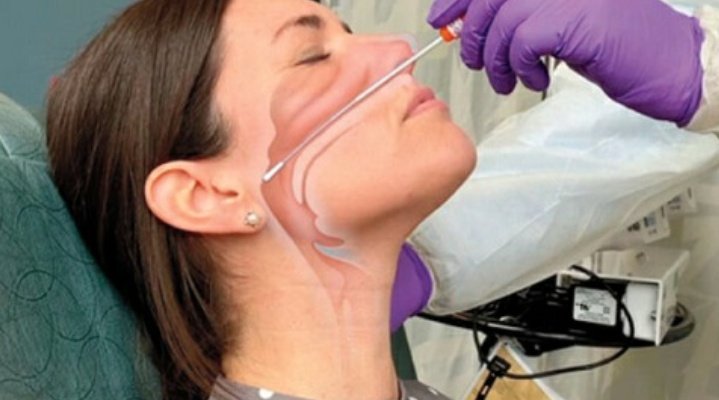 Мазок через нос. Забор мазка из носоглотки. Сбор мазка из зева и носа алгоритм. Эндоскопия носоглотки аденоиды. Мазок со слизистой оболочки носа.