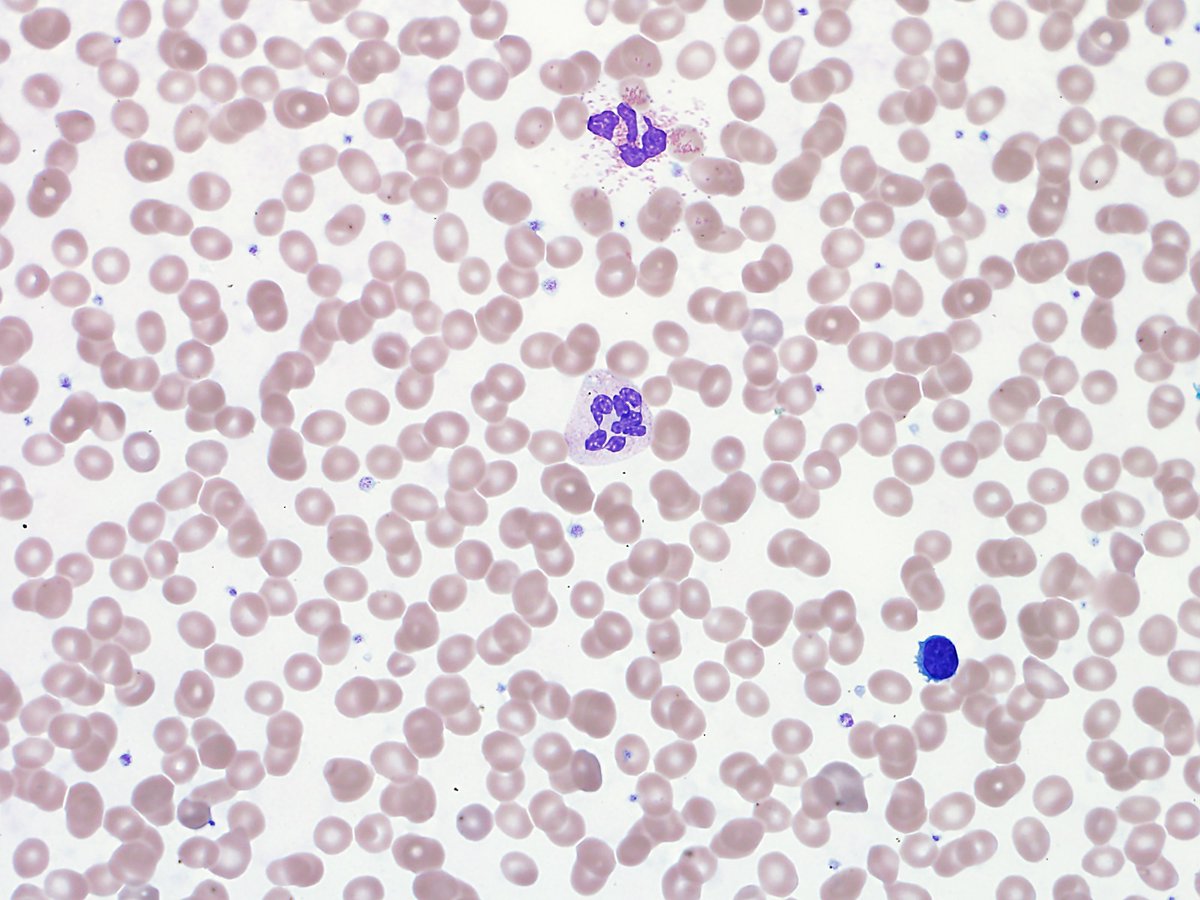 Mrinal Patnaik tweet media