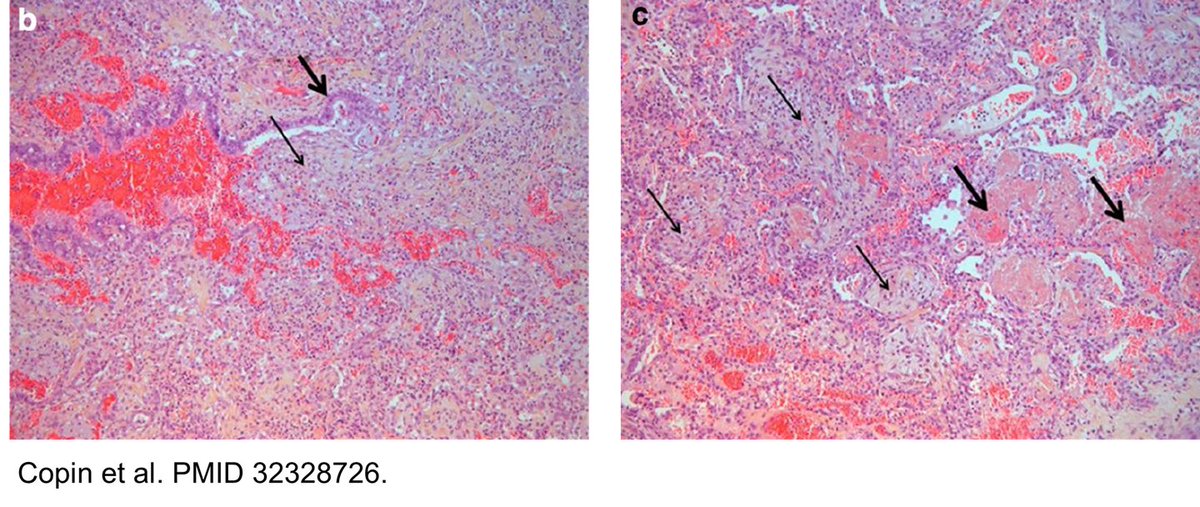 Victor Tseng tweet media