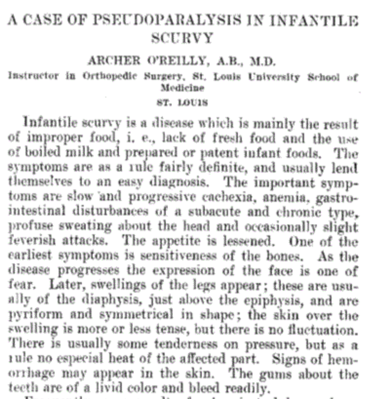Here's a journal article from 1910 about infantile scurvy. This was a problem for kids of the wealthy! In 1910! Here is medical science just a few years before the discovery of Vitamin C, with a correct diagnosis, correct analysis (the problem is dietary), but no way to cure it.