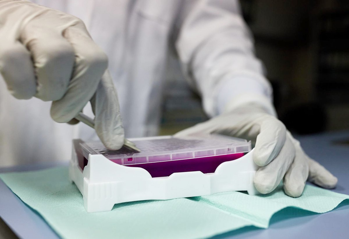 sudestada_uy's tweet photo. #Uruguay publica menos datos sobre el #coronavirus que otros países de la región
Sin pautas claras para seguir, las autoridades divulgan informes donde no se incluyen toda la información disponible. La sociedad civil reclamó #transparencia 
https://t.co/qim6J9eSVs https://t.co/pdQ02AhrLY