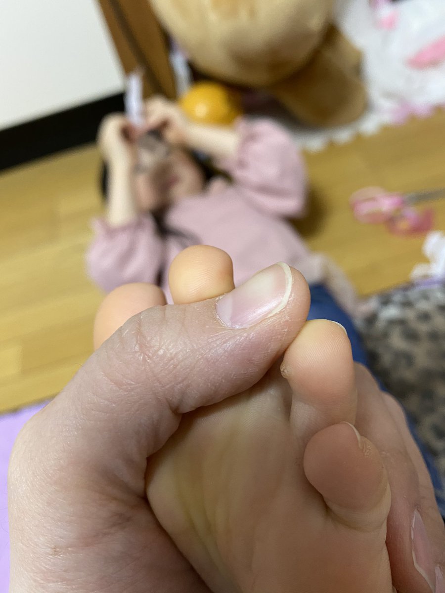 伊藤 ぴょ 多忙中 これタコ 昔の子供ってよく足の裏にタコ 魚の目 的なのできてなかったっけ W 昭和丸出しw それと同じ感じのやつなのかなぁ 明日皮膚科行って見てもらうかぁ ノd 子供 魚の目 足 伊藤 ぴょ 多忙中 これタコ 昔の子供ってよく足の裏にタコ 魚の目 的なのできてなかったっけ W 昭和丸出しw それと同じ感じのやつなのかなぁ 明日皮膚科行って見てもらうかぁ ノd 子供 魚の目 足