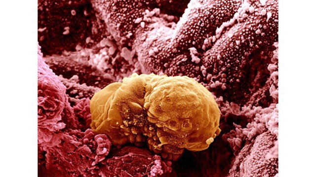 MicroscopcWorld's tweet photo. 6 day old human embryo is beginning to implant into the endometrium, the lining of the uterus. https://t.co/xIPTWgdEPT