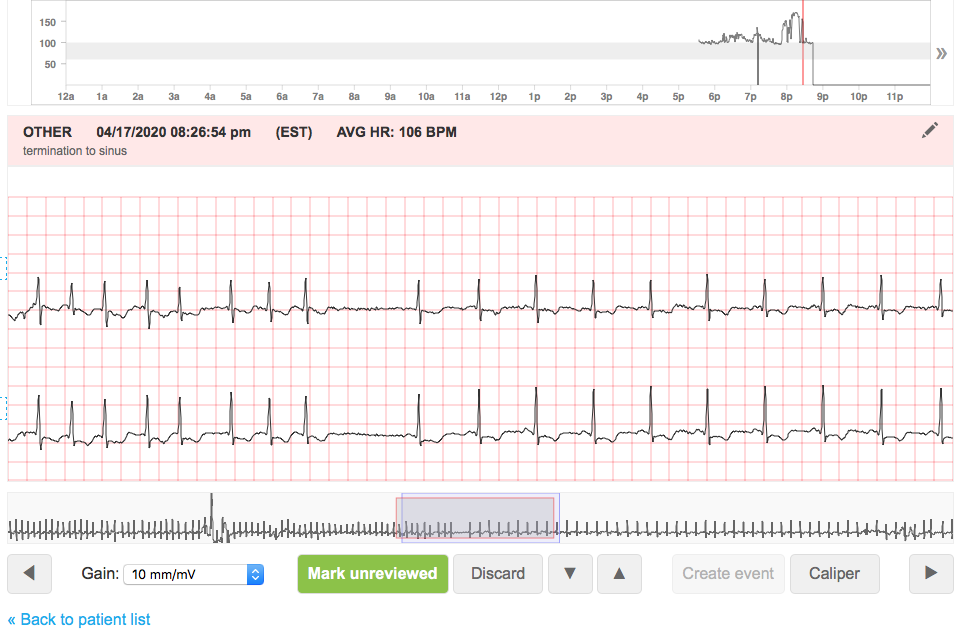 CMovsowitz's tweet photo. True mobile telemetry with heart rate trend provides opportunity for remote diagnosis and treatment in real time - valuable in preventing unnecessary ER visits in era of COVID19. https://t.co/uN4uQ6DcSw