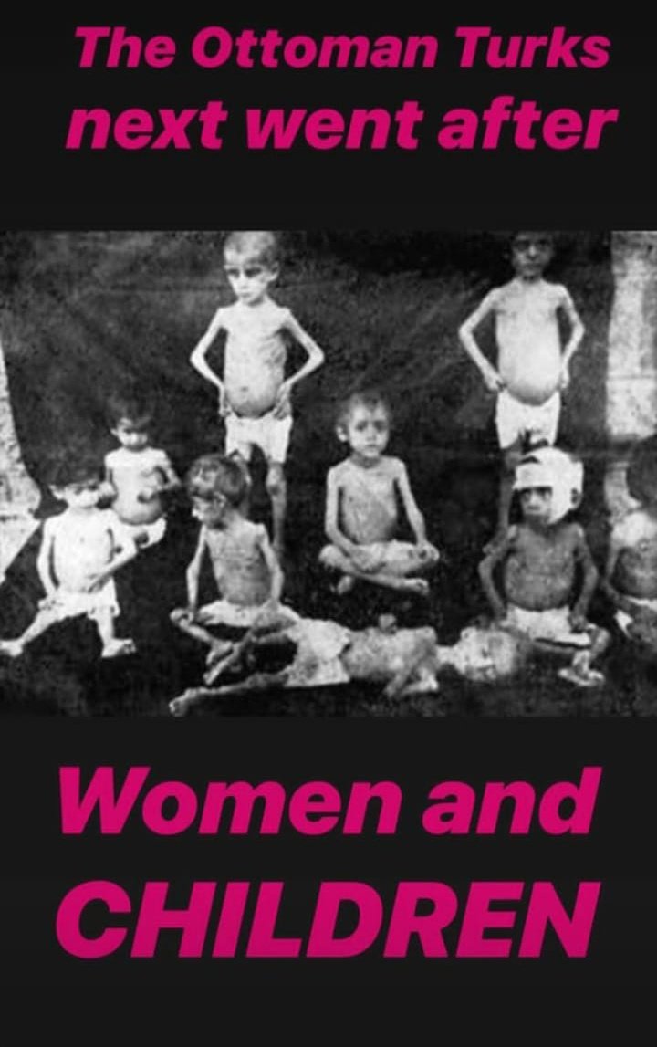 Kim aşko niye beyninin de plastik olduğunu söylemiyosun aaa ayıp ama #KimKardashian