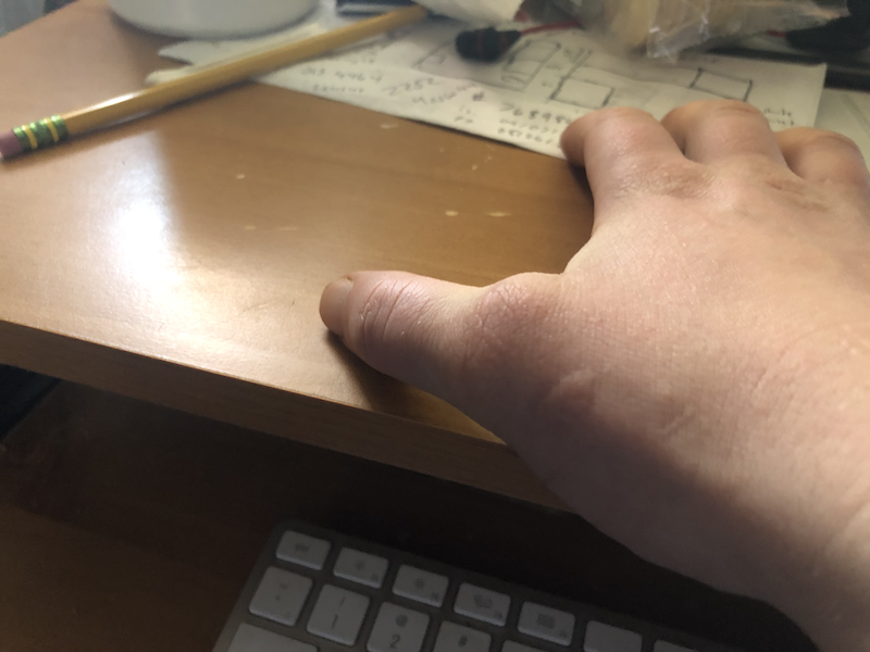Little did I know, as I deftly peeled the foil off that grilled cheese, that I was narrowing down to the last half hour of when my right thumb would work properly and painlessly(My thumb the next day; my thumb today)