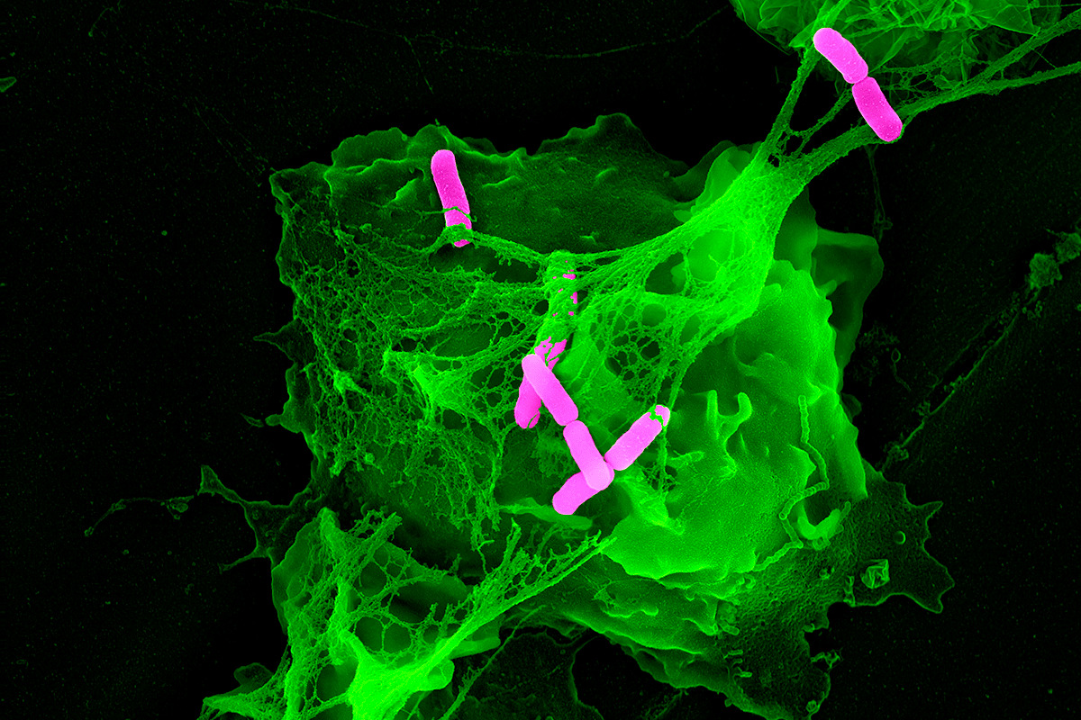 Speaking of nets, neutrophils (PMNs) can act as fishermen/fisherwomen (better than guys above)PMN NETs (neutrophil extracellular traps) occur as the neutrophils rapidly extrude their intracellular DNA, leading to a proteinaceous net that helps trap & kill bacteria (see below)