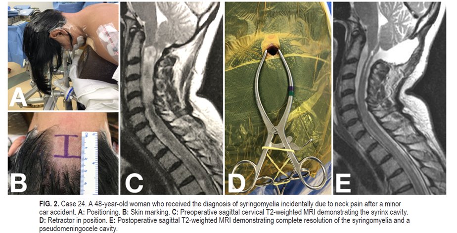 Journal of Neurosurgery tweet media