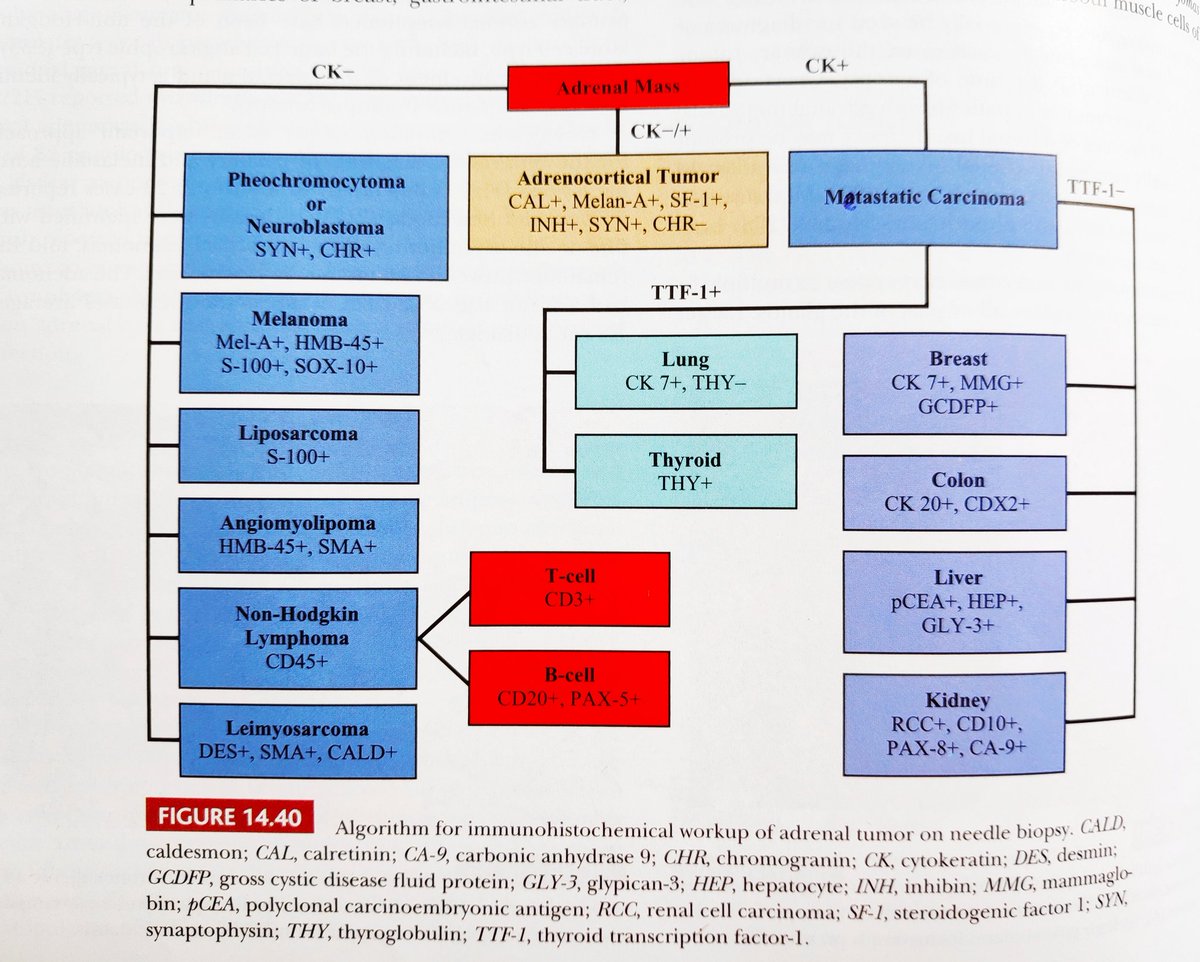 Found a good algorithm for #IHCpath workup of adrenal tumors. Courtesy Sternberg's Diagnostic Surgical Pathology. Makes me want to trace the source article 😊. Anyone wants to add more to this? #pathology #EndoPath #AdrenalTumors