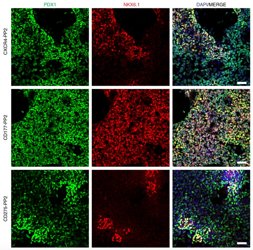 NatureBiotech's tweet photo. Generation of pancreatic β cells from CD177+ anterior definitive endoderm https://t.co/LmhLFqtxdS https://t.co/WjV821ES73