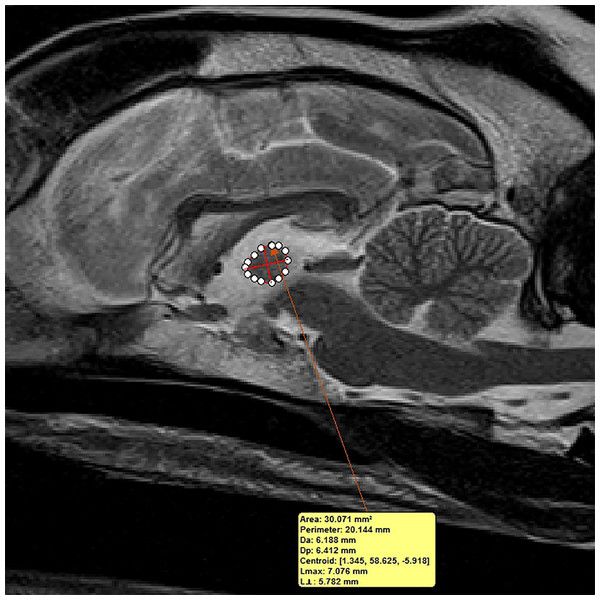 Albinovet's tweet photo. interthalamic adhesion size in aging dogs with presumptive spontaneous brain microhemorrhages: a comparative retrospective MRI study of dogs with& without evidence of canine #cognitive_dysfunction. https://t.co/D3IO62kBl5 https://t.co/2Vq6SILJBj