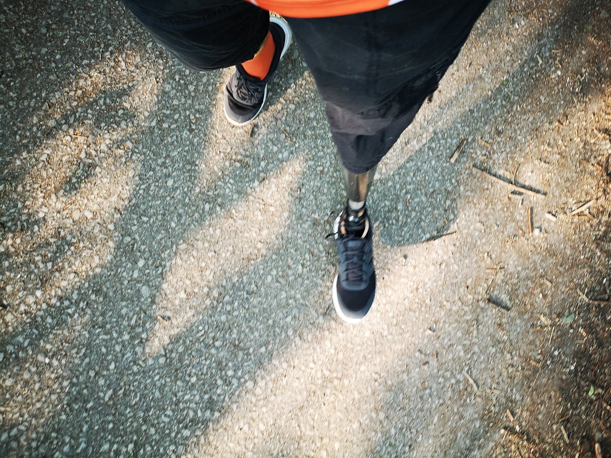 Hopalonglloydy's tweet image. I thought this was worth sharing again. Having a team of amazing physios, and a brilliant prosthetist from @MFTnhs #SpecialisedAbilityCentreWythenshawe and to @ottobockuk for the #CLegExperience this was only after a couple of months using it.