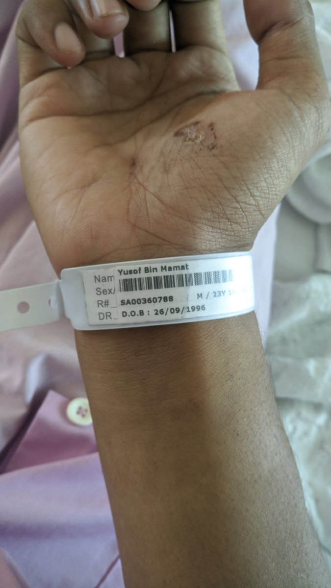 Lampiran : 4 tulang rusuk patah and hemothorax, gigi patah, calar calar sikit, 11 hari di hospital 11/11/2019 - 22/11/2019. Rusuk patah nak bernafas punya susah bayangkan kalau setiap hari kena kena panik attack? Yang pernah rasa tu tahulah.