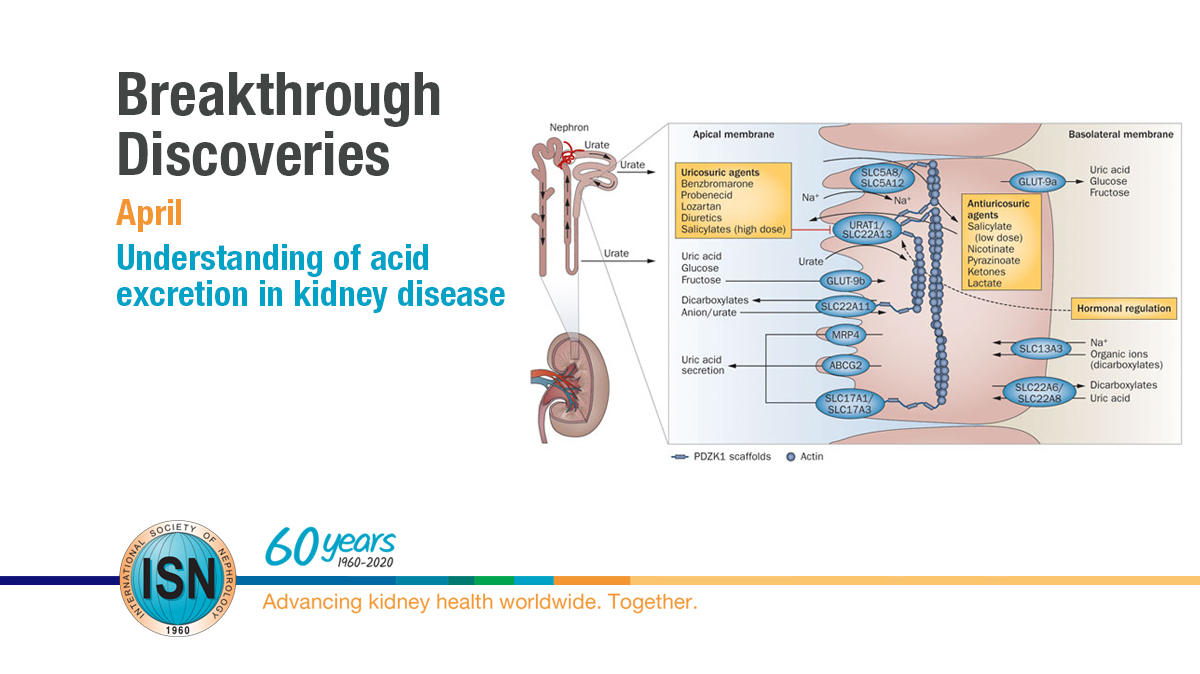  Understanding of acid excretion in kidney disease https://www.theisn.org/60th-anniversary/breakthrough-discoveries/breakthroughs-in-april/understanding-of-acid-excretion-in-kidney-disease  #ISN60years