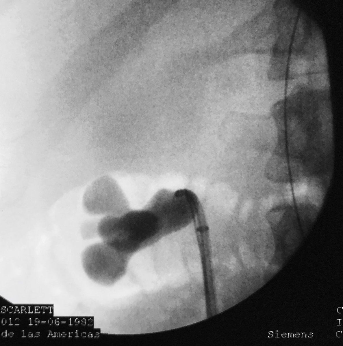 PCNL challenges tweet media