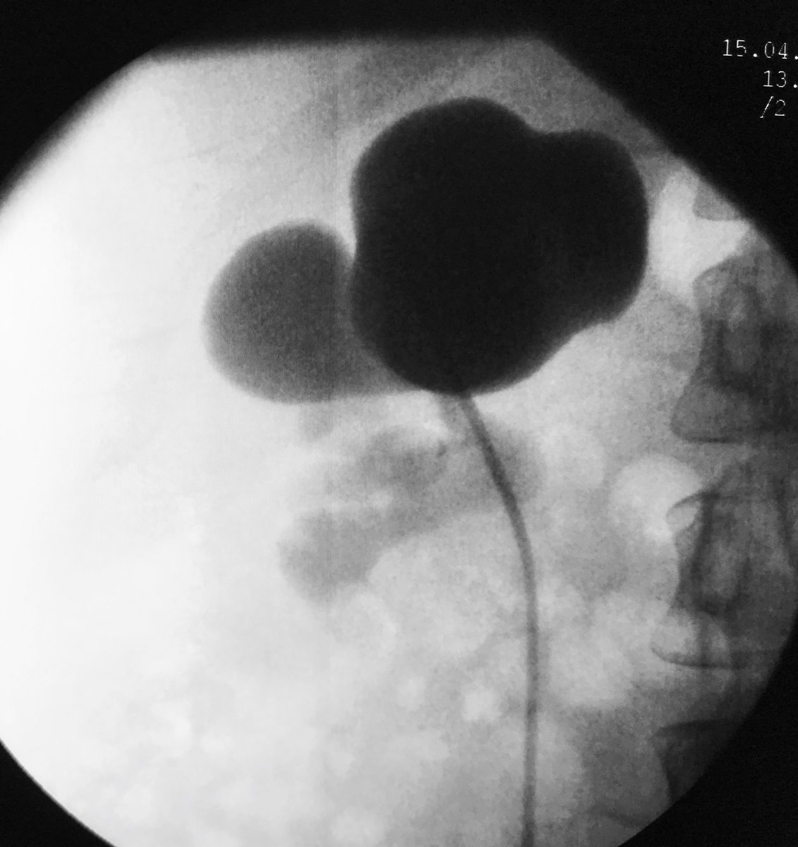 PCNL challenges tweet media