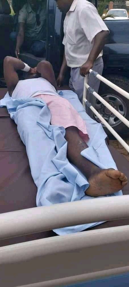 NubianBukenAli's tweet photo. #HonZaake brutally tortured by #Ugandagovernment operatives! I Pity this government. Shame on you! https://t.co/mYkovh7bZX