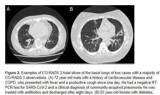 RadiologyEditor's tweet photo. RADIOLOGY New:  Validation of CO-RADS for classifying #COVID19 19 on chest CT; 8 observers, validation with RT-PCR results.  https://t.co/bQHCggHRwX #CTRad #radiology @radiology_rsna https://t.co/dwPS2YYQwh