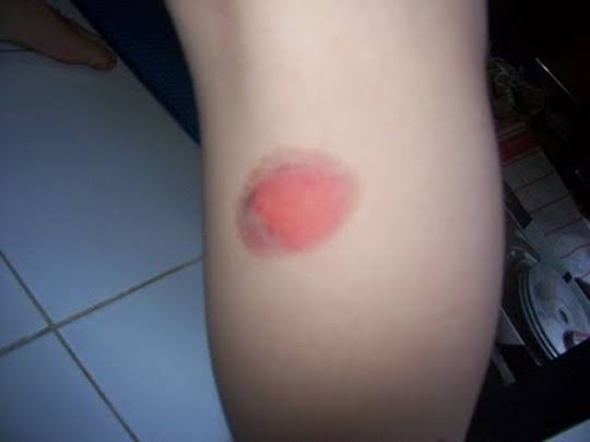 Bang LeDesh nih bang kena knalpot jialing <a href="/riopambvdi/">Mendung tanpa ujan</a> <a href="/rifkibukan/">Rifki Pratama</a> <a href="/rifyaldiiqbal/">Iqbal Rifyaldi</a> #sawityowit