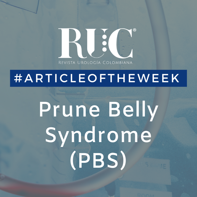 Urocojournal's tweet photo. #ArticleOfTheWeek #RUC20 #PBS #ReconstructiveUro #UrinaryTract @ThiemeNY
Follow up of Patients with Eagle-Barett (Prune Belly) Syndrome Treated with Single-Stage Abdominoplasty and Total
Access it here: https://t.co/9MVp1jKkh8 https://t.co/D2UyO30c3j