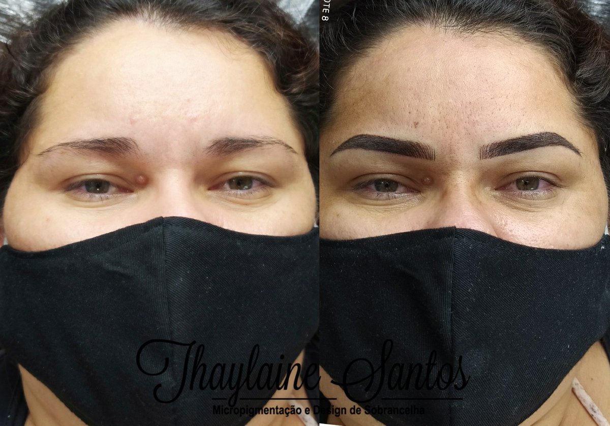 AtelieThay's tweet photo. O que acharam dessa mudança ?😱🔥✨
Micropigmentação Técnica Shadow com Fios✍️
...#Rbkollos #pigmento #top #micropigmentação #micro #microblading #shadow #tecnicashadow #efeitomake #makeup #permanente #yebrows #tebori #dermografo #sobrancelhasdosonho #sobrancelha #top https://t.co/tWtqQbVyL0