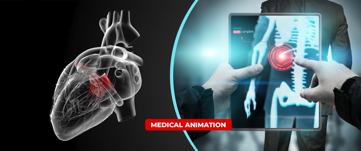 MediBillExperts's tweet photo. We possess an expert bunch of creative 2D medical animation and 3D medical animation services to professionals.
Visit: https://t.co/pcNeHjmjaz
Email: support@medibillingexperts.com
#MedicalAnimation #HealthcareAnimation #2DAnimation #3DAnimation #HealthcareModels #MedicalModels https://t.co/RUQJy4xtmY