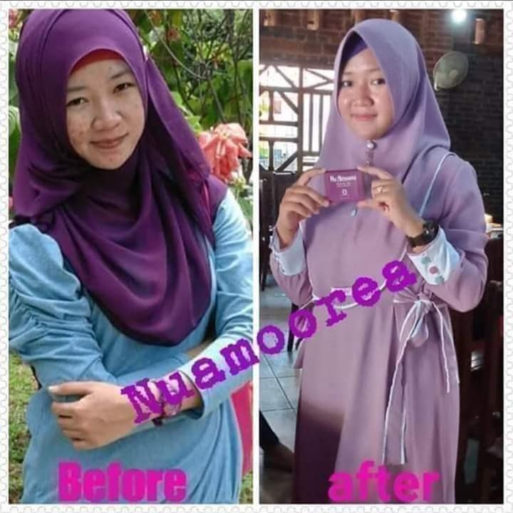 ani_rizqi's tweet photo. Tidak ada istilah TIDAK COCOK kalau sudah pakai Sabun Nu Amoorea .

Yg merasa tidak cocok adalah orang yg tdk mau menerima kenyataan bahwa dia adalah mantan Si Racikan dan abal2😂😂😂
Udah,move on aja.

Sabar dan telaten kunci dpat kulit sehat ala #NuAmoorea https://t.co/d8JWYE8qJx