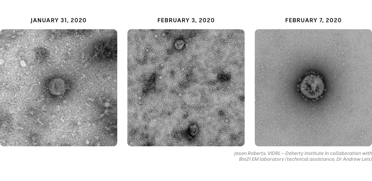 ABCscience's tweet photo. These were some of the first images ever taken of the coronavirus that causes #COVID19. They were created by two scientists in Melbourne using a transmission electron microscope.

"You’re looking at the enemy," says Dr Jason Roberts.

See it for yourself: https://t.co/UxbtHtfw3Z https://t.co/8y8Jmw5pDx