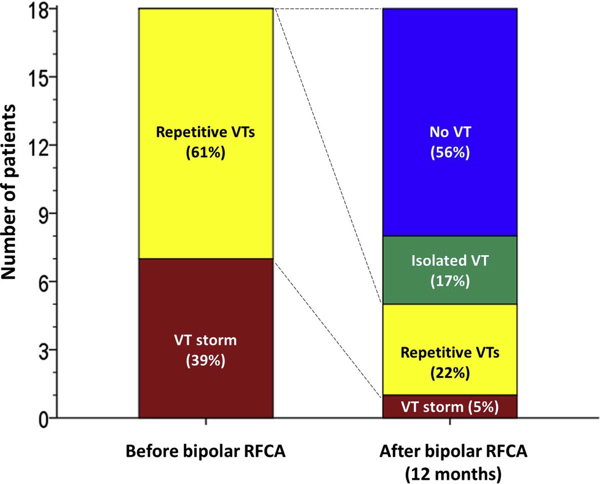 Akihiko Nogami (@akihikonogami) on Twitter photo “Acute and long-term results of bipolar RF catheter ablation of refractory ventricular arrhythmias of deep intramural origin” just accepted in Heart Rhythm <a href="/shivkumarmd/">Kalyanam Shivkumar MD PhD</a> @andreanatalemd <a href="/LuigiDiBiaseMD/">Luigi Di Biase</a> <a href="/DrRoderickTung/">Roderick Tung</a> <a href="/PrashSanders/">Prash Sanders</a> <a href="/shirai_yasuhiro/">Yasuhiro Shirai</a> <a href="/Dr_Santangeli/">Pasquale Santangeli</a>
<a href="/hrs_journal/">HeartRhythm</a> “Acute and long-term results of bipolar RF catheter ablation of refractory ventricular arrhythmias of deep intramural origin” just accepted in Heart Rhythm <a href="/shivkumarmd/">Kalyanam Shivkumar MD PhD</a> @andreanatalemd <a href="/LuigiDiBiaseMD/">Luigi Di Biase</a> <a href="/DrRoderickTung/">Roderick Tung</a> <a href="/PrashSanders/">Prash Sanders</a> <a href="/shirai_yasuhiro/">Yasuhiro Shirai</a> <a href="/Dr_Santangeli/">Pasquale Santangeli</a>
<a href="/hrs_journal/">HeartRhythm</a>
