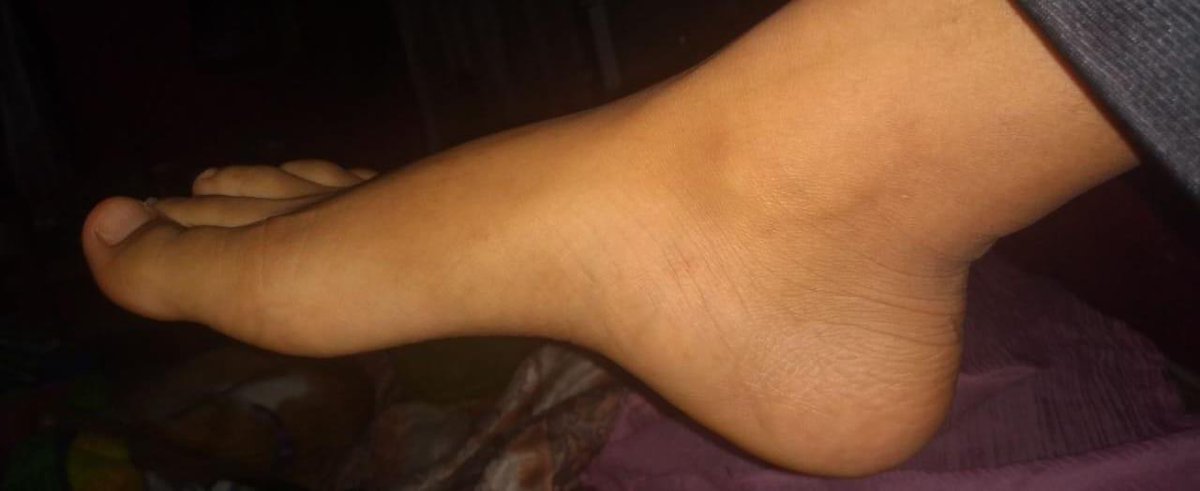 Feets_07's tweet photo. #Feet 😍😍😍😘 https://t.co/fm25i1xlJw
