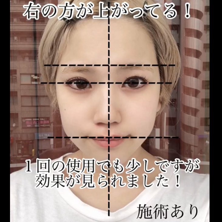 田中みな実 さんが愛用♡ 話題になった #セルキュア4tplus 4つの