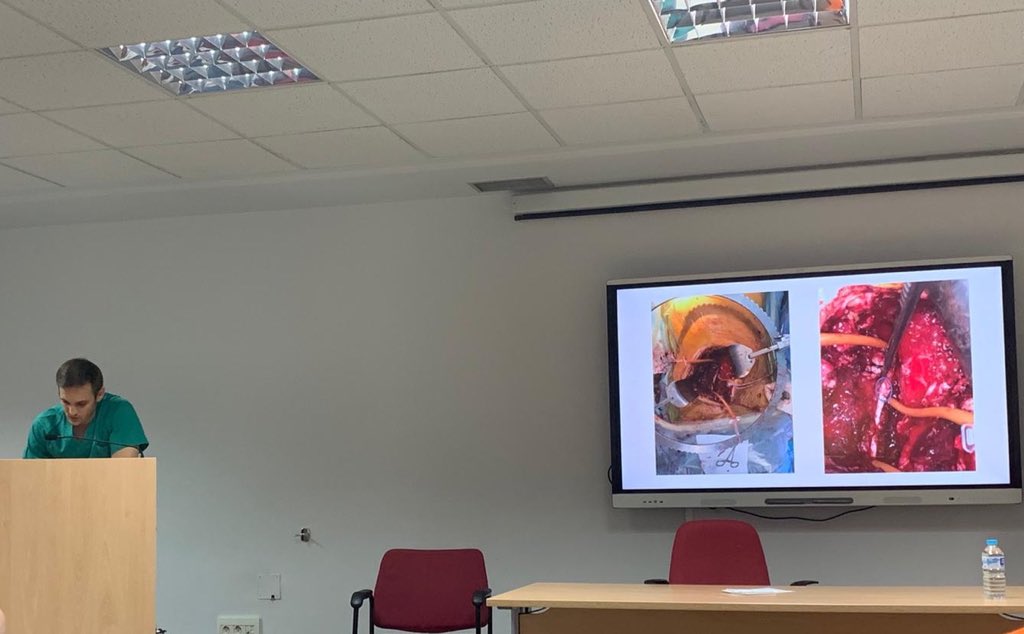 javierlorcal's tweet photo. Finally the coronavirus has let me present my excellent external rotation in Coimbra! It couldn’t be better!! 100% recommended! Muito obrigado🇵🇹 @sutr_nesu @RobertoLSMJ @TavaresElv @Lorenzo_marconi @jonicarvalho2 @migueleliseu @ResidentesAEU @eau_yuo https://t.co/rUiq37YmP1