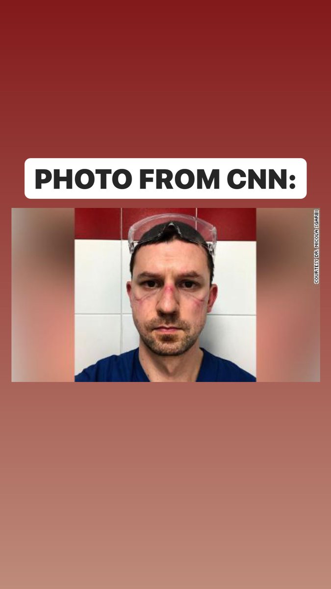 Look at the original photo published by CNN compared to the photo in the tweet. Notice anything different? We can clearly observe the bruising in the photo included in the tweet looks more pronounced and dramatic.