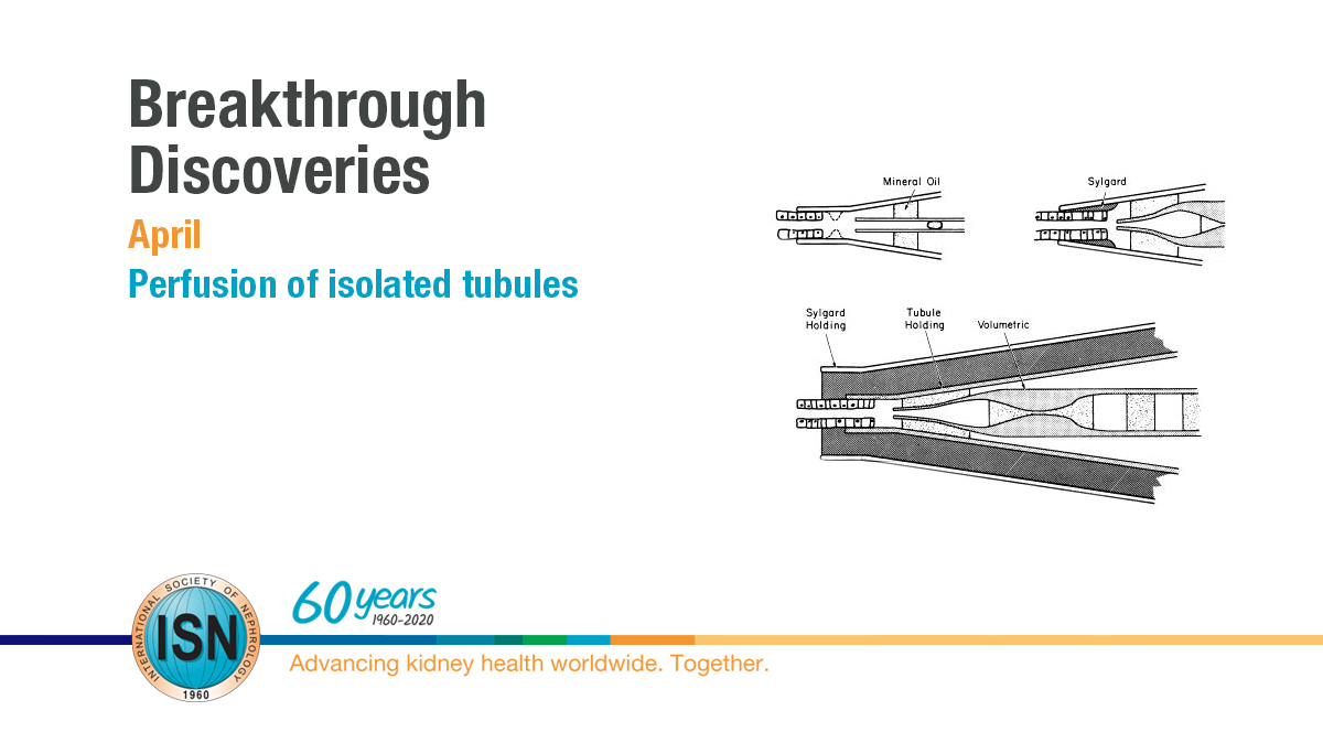  Perfusion of isolated tubules https://www.theisn.org/60th-anniversary/breakthrough-discoveries/breakthroughs-in-april/perfusion-of-isolated-tubules  #ISN60years