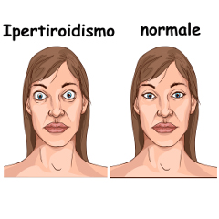 ISSalute_it's tweet photo. La carenza di ormoni tiroidei (ipotiroidismo), può causare obesità, infertilità e malattie cardiache ▶️ https://t.co/b1NBGivhRb  #ipotiroidismo #tiroide #issalute https://t.co/CtYM3i9Cfm