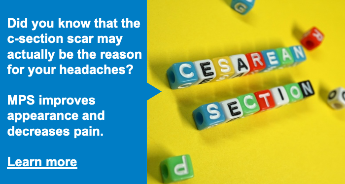 PainExpertKelly's tweet photo. Did you know that the c-section scar may actually be the reason for your headaches?

MPS improves appearance and decreases #pain, both at the site of the #scar and anywhere else in the body that scar may be affecting.

Learn more:
https://t.co/oYpKoeYRmh

#DolphinMPS #ScarRelease https://t.co/Xok83t90SB