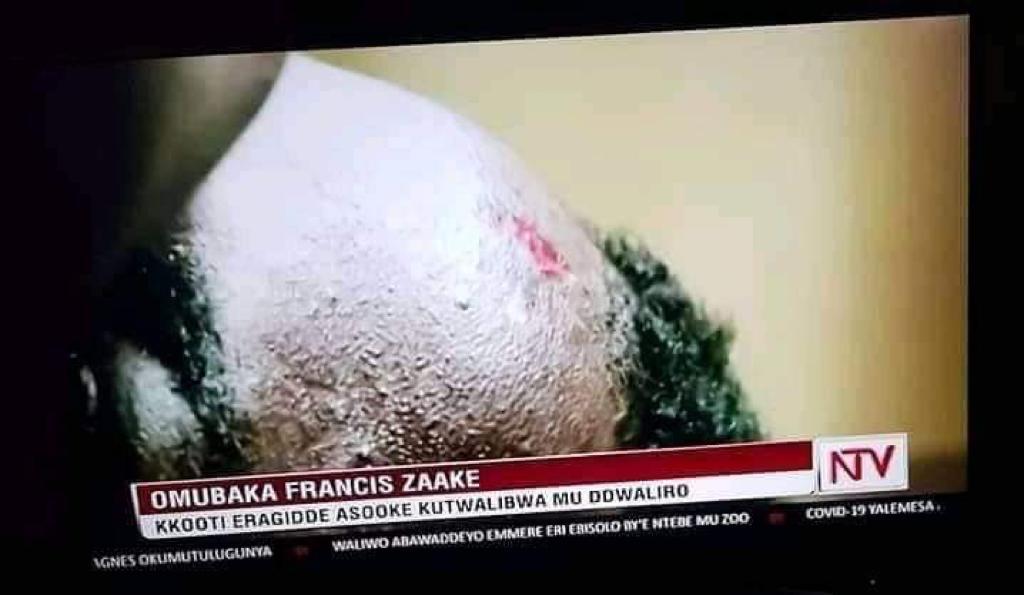 hillarytaylorvi's tweet photo. Despot Museveni #FreeZaake NOW alive or dead. Feeding the vulnerable should never be a crime in Uganda or elsewhere. If a legislator is tortured like this, how about we the wanainchi?. Uganda has a Human Rights crisis now not Covid-19 pandemic.
#RespectHumanRights https://t.co/oaM6ZXhP17