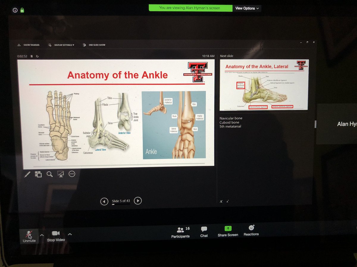 TXTechSportsMed's tweet photo. Fun experience today of learning to teach virtually! Musculoskeletal workshop with 3rd year Fam Med Clerks. Dr. Edwards and the fellows did great! @TTUHSCdome @TTUHSC @DrBerk https://t.co/X6JGYIpuzF